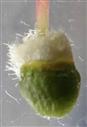  Hypanthium with ovary